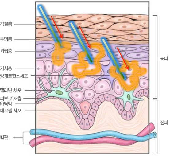 피부 단층 이미지, 각질층,투명층, 과립층, 가시층, 랑게르한스세포, 멘라닌세포, 피부 기저층, 바닥막, 메르겔 세포, 혈관 순으로 구성